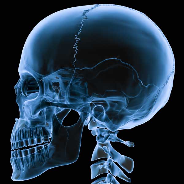 Medication-Related Osteonecrosis of the Jaw